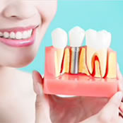 残っている歯を「守る」ための治療 インプラント治療はこちらから
