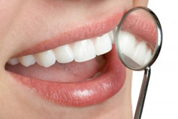 審美歯科と歯周病
