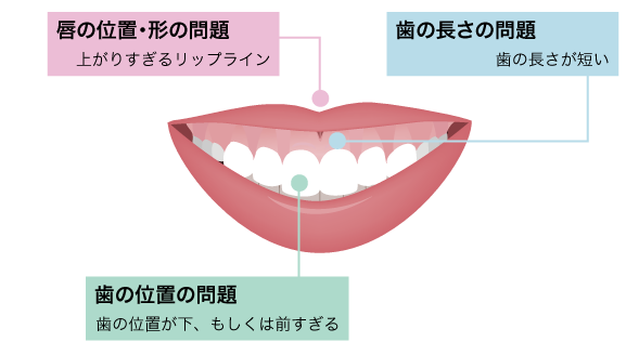 3つに分類される症状・原因