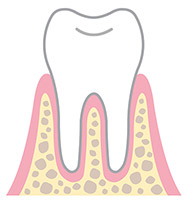 健康な歯肉