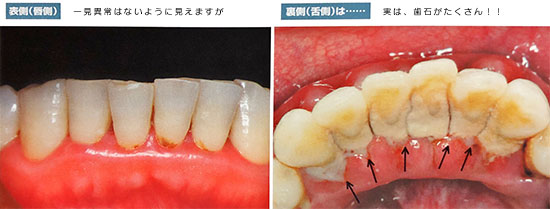 PMTCイメージ