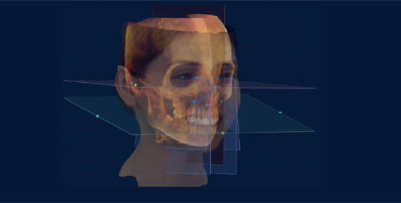 顔の3Dデータに頭部のCTを重ねた画像