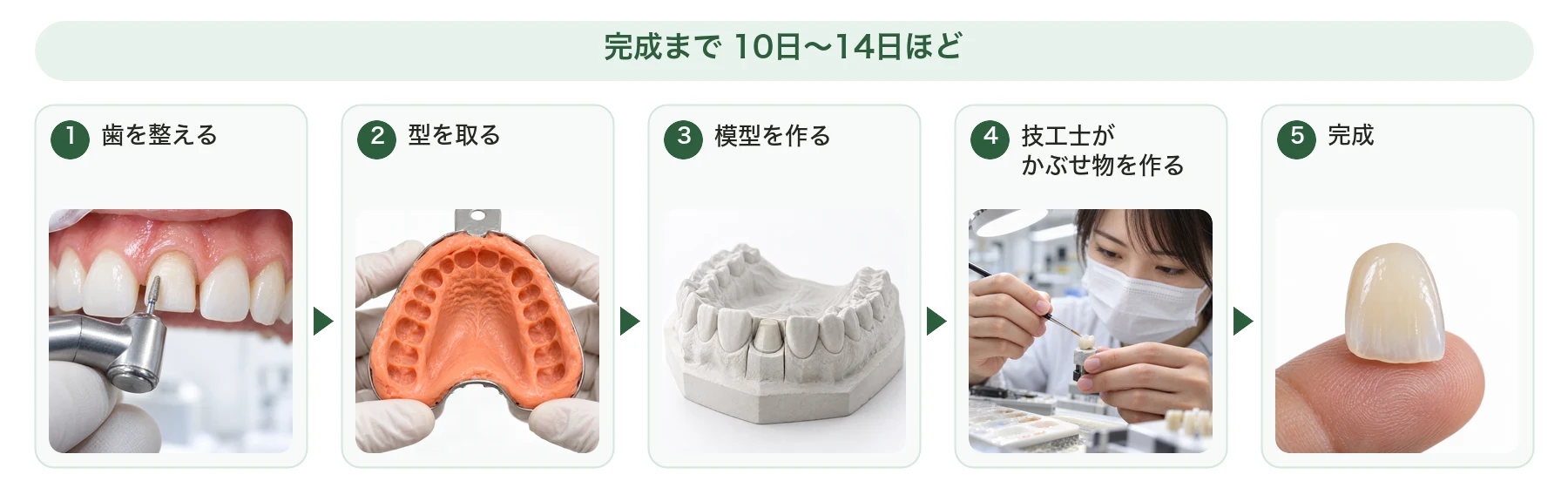 かぶせ物を技工所で作る流れ。1 歯を整える、2 型を取る、3 模型を作る、4 技工士がかぶせ物を作る、5 完成。完成まで10日〜14日ほど