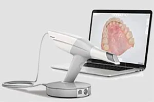 お口の中を読み取る3D光学スキャナーと、画面に映った歯並びのデータ