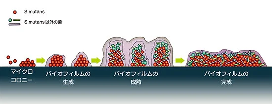 細菌が歯の表面に付き、小さな集まりからバイオフィルムとして成熟していくまでの段階の図