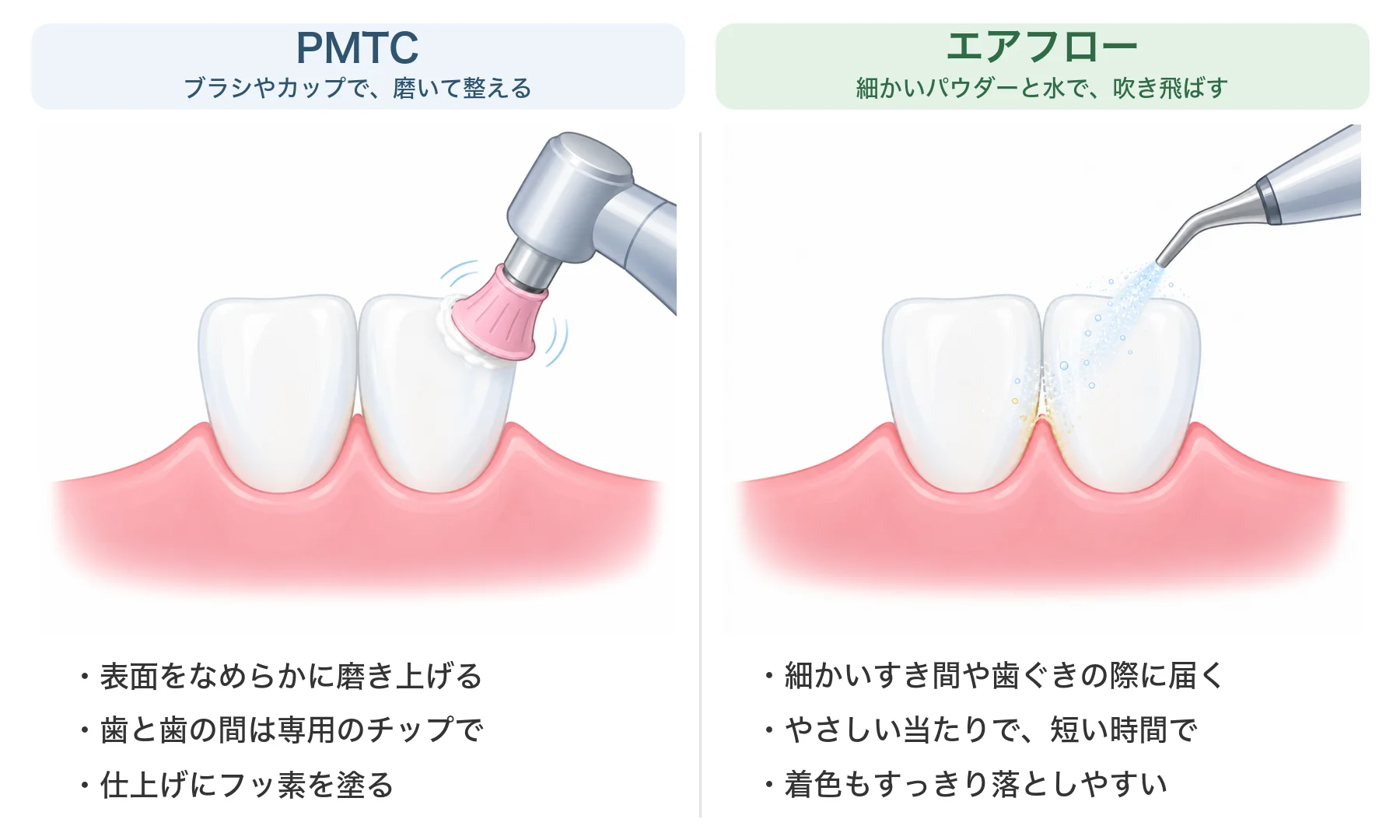 PMTCとエアフローの違いのイラスト。左はゴムのカップで歯の表面を磨くPMTC、右は細いノズルからパウダーと水を吹きつけて、歯と歯の間や歯ぐきの際の汚れを飛ばすエアフロー